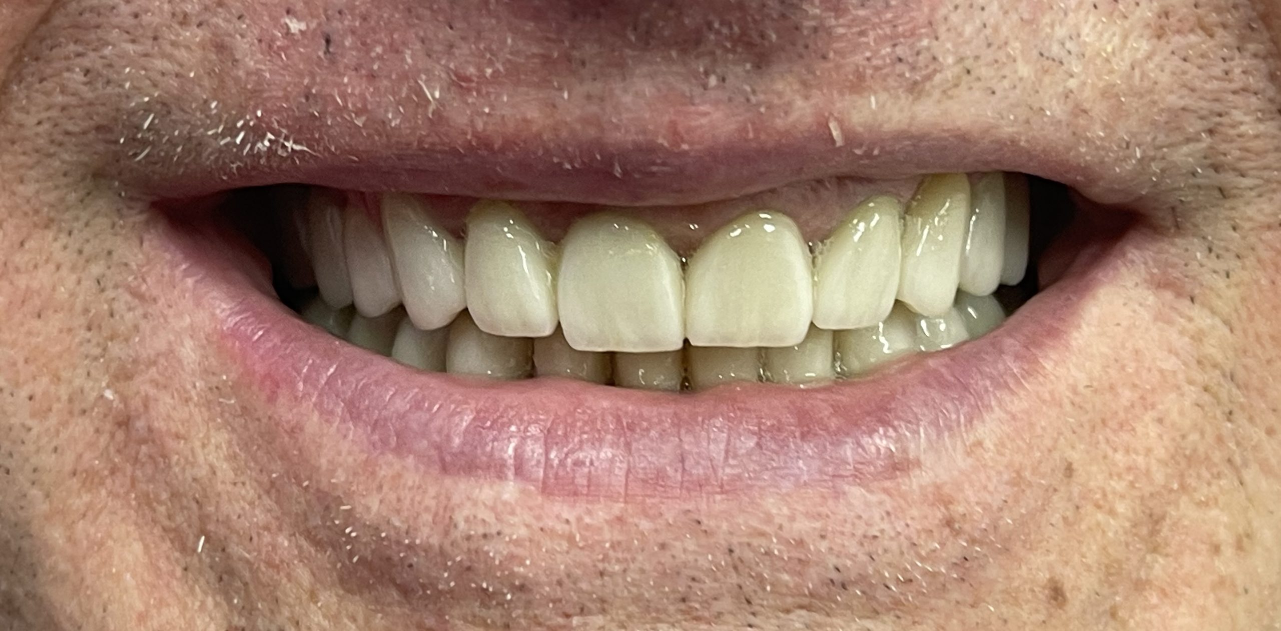 Protetica dentara reabilitare orala